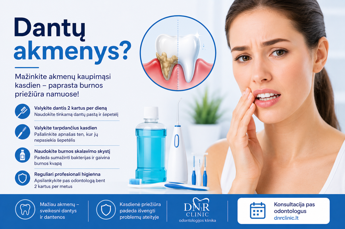 Kaip sumažinti dantų akmenų kaupimąsi namuose?