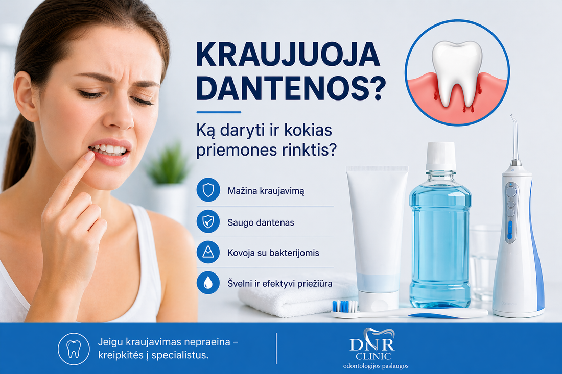Kraujuoja dantenos – ką daryti ir kokias priemones rinktis?