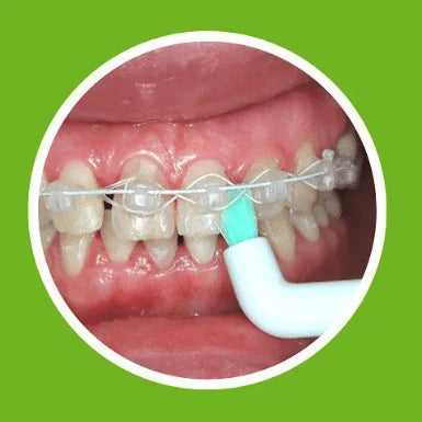 ApaCare Sonic 3D Sensitive šepetėlio galvutė (vieno danties)